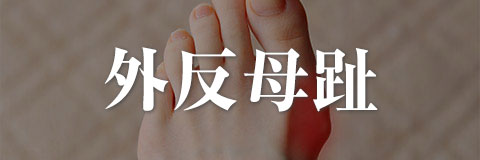 外反母趾